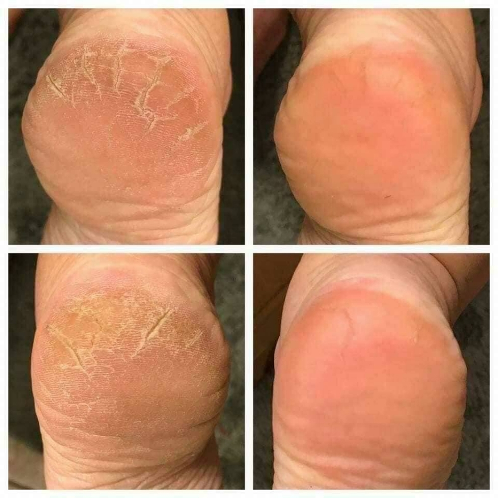 Sole Solution foot balm